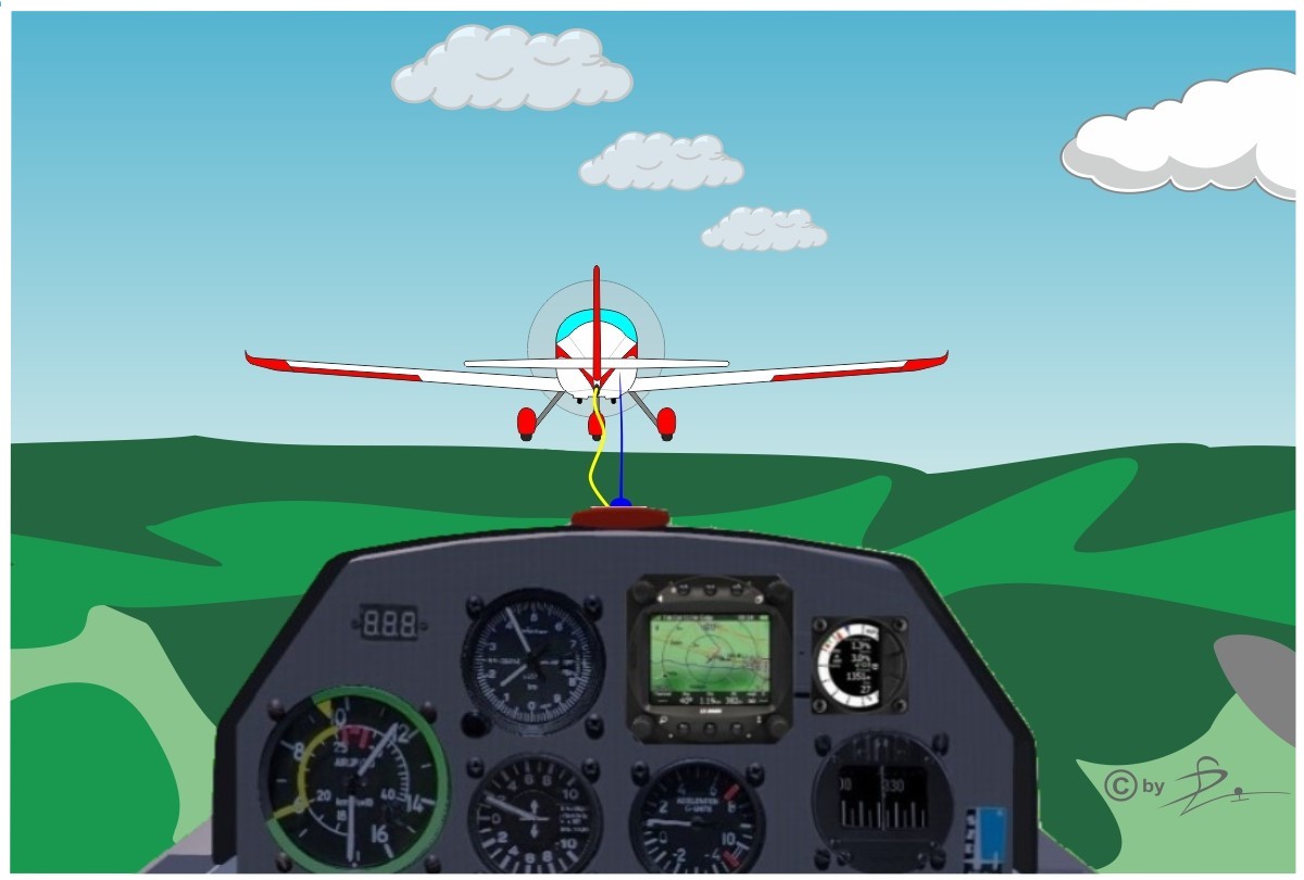 6 Normallage einnehmen bearbeitet